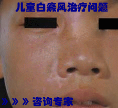 ޽ˮΰ
