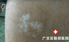 Щɰ粡