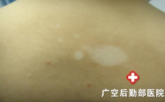糣Ʒ