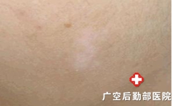 縴Щɵ