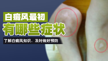 ڻӦ