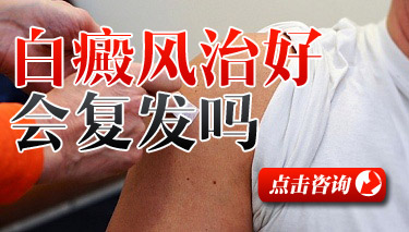 粻ٸο