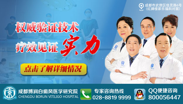 ɶƻǮ
