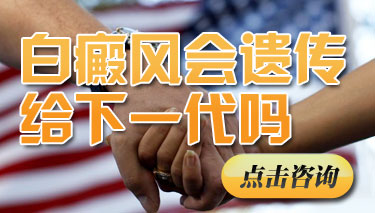 白癜风有没有遗传性 白癜风有没有遗传性