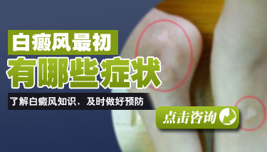 ���综��֢״