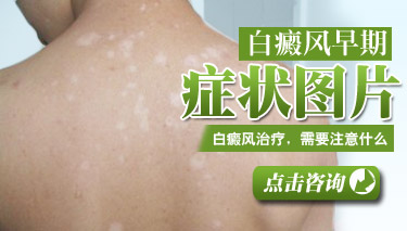 先天性<a href=http://bdf.jdnews.com.cn/bdf/ target=_blank class=infotextkey><a href=http://bdf.jdnews.com.cn/bdf/bdfzz/ target=_blank class=infotextkey><a href=http://bdf.jdnews.com.cn/bdf/bdftp/ target=_blank class=infotextkey>白癜风的早期症</a>状</a></a>