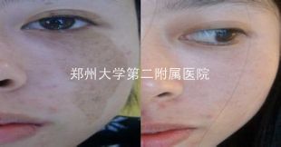 u=445147399,1551184514&fm=21&gp=0.jpg