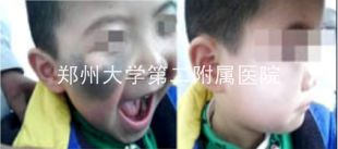 ֣̥