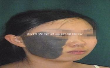 ֣̥ҽԺ